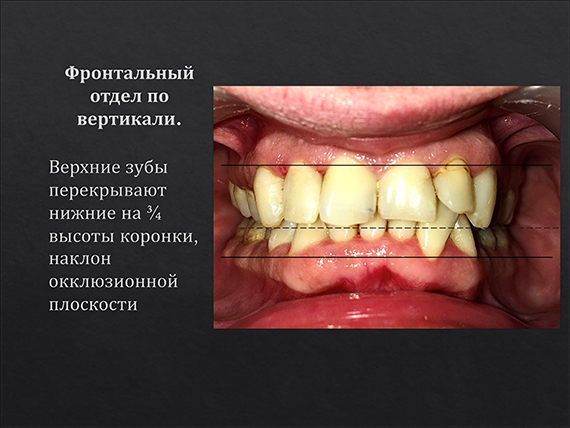 prezent_14